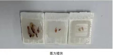 什么是病理蜡块蜡块与切片是什么？可以外借么？_https://www.jmylbn.com_新闻资讯_第3张