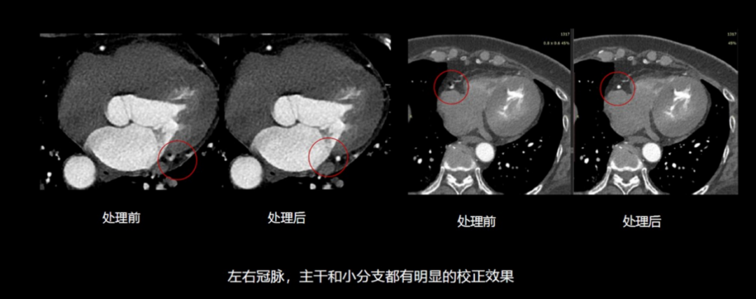 联影ct怎么样【小南快讯】辐射低、成像快、更精确！CT届的“天花板”——320排640层超高端CT落户奉中心！_https://www.jmylbn.com_新闻资讯_第10张