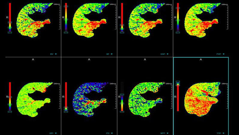 联影ct怎么样【小南快讯】辐射低、成像快、更精确！CT届的“天花板”——320排640层超高端CT落户奉中心！_https://www.jmylbn.com_新闻资讯_第21张