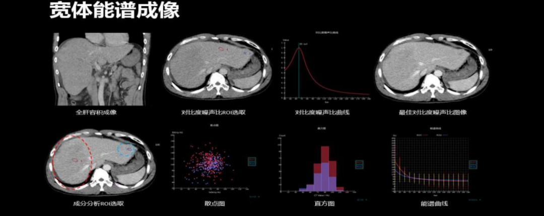 联影ct怎么样【小南快讯】辐射低、成像快、更精确！CT届的“天花板”——320排640层超高端CT落户奉中心！_https://www.jmylbn.com_新闻资讯_第20张