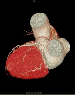 联影ct怎么样【小南快讯】辐射低、成像快、更精确！CT届的“天花板”——320排640层超高端CT落户奉中心！_https://www.jmylbn.com_新闻资讯_第9张