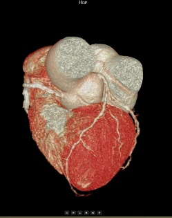联影ct怎么样【小南快讯】辐射低、成像快、更精确！CT届的“天花板”——320排640层超高端CT落户奉中心！_https://www.jmylbn.com_新闻资讯_第8张