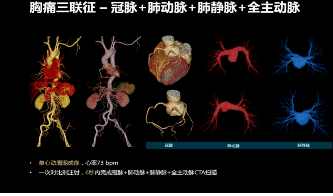 联影ct怎么样【小南快讯】辐射低、成像快、更精确！CT届的“天花板”——320排640层超高端CT落户奉中心！_https://www.jmylbn.com_新闻资讯_第16张