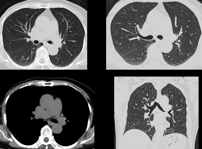 联影ct怎么样【小南快讯】辐射低、成像快、更精确！CT届的“天花板”——320排640层超高端CT落户奉中心！_https://www.jmylbn.com_新闻资讯_第17张