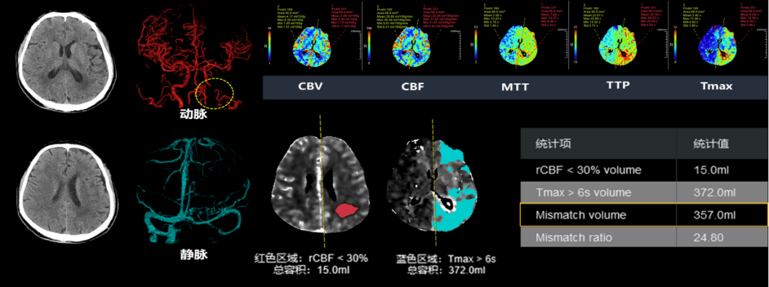 联影ct怎么样【小南快讯】辐射低、成像快、更精确！CT届的“天花板”——320排640层超高端CT落户奉中心！_https://www.jmylbn.com_新闻资讯_第14张