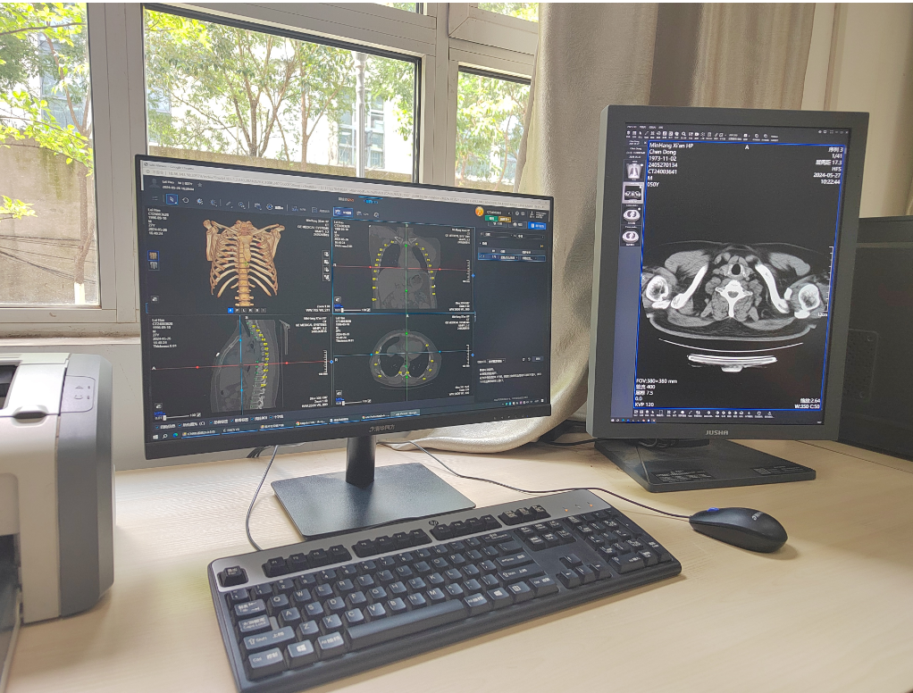 医讯怎么用【医讯】精准医疗，AI助力！——民航西安医院放射科应用人工智能（AI）辅助诊断系统_https://www.jmylbn.com_新闻资讯_第4张