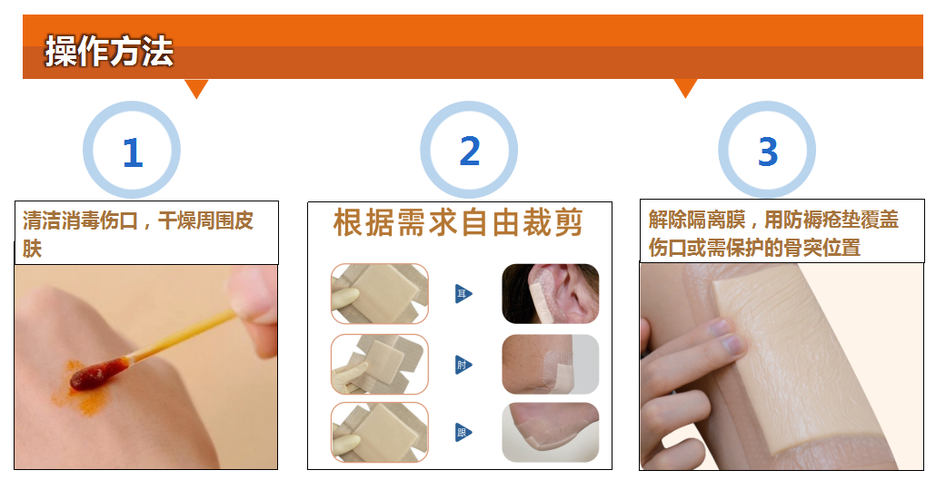 医用泡沫贴怎么用压疮护理不用愁！医用褥疮贴买一送一！_https://www.jmylbn.com_新闻资讯_第8张