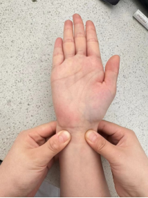 动脉什么压迫止血【健康科普】各部位指压止血方法，建议收藏_https://www.jmylbn.com_新闻资讯_第7张