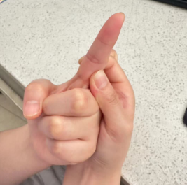 动脉什么压迫止血【健康科普】各部位指压止血方法，建议收藏_https://www.jmylbn.com_新闻资讯_第8张