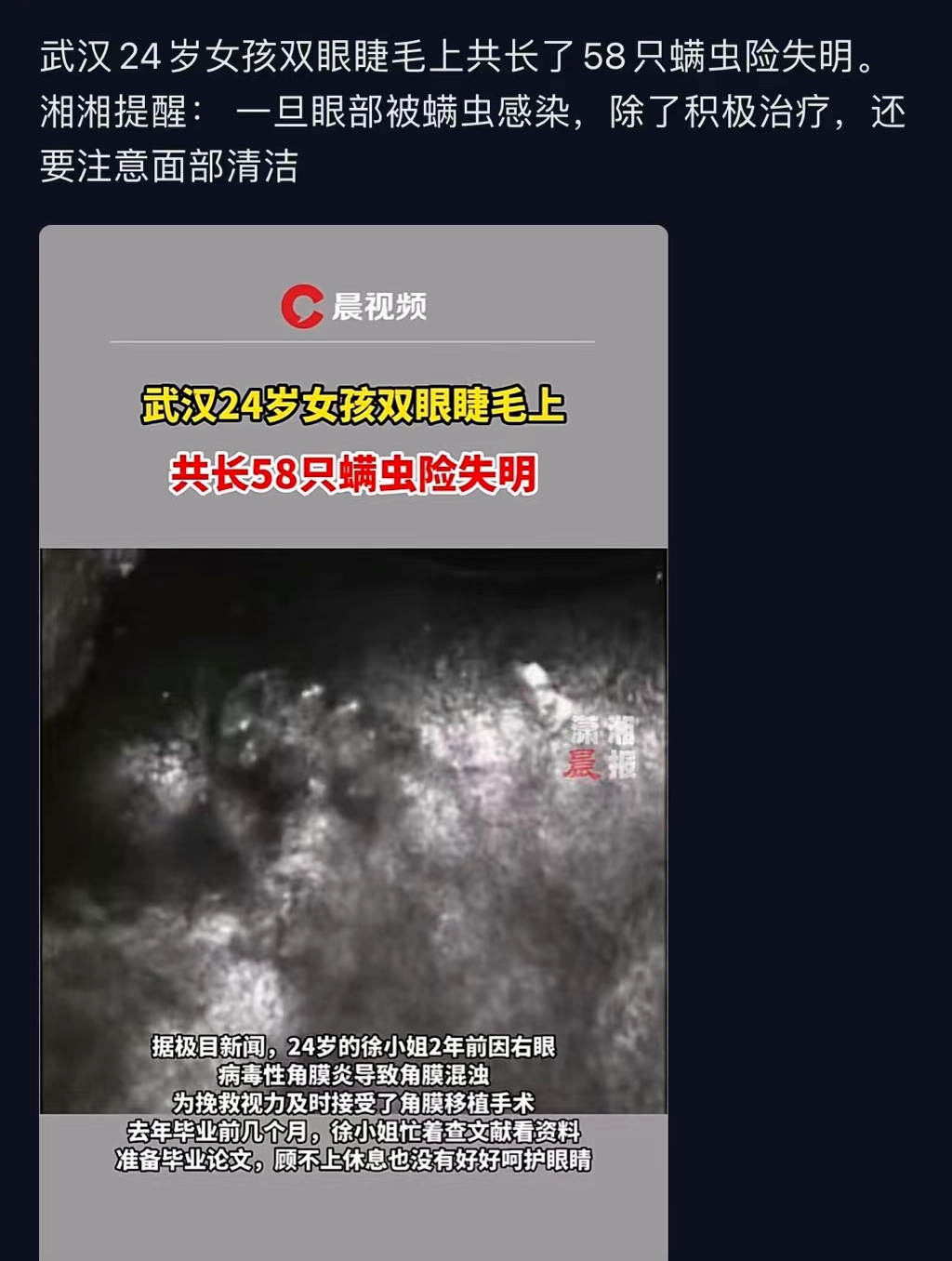 孕妇闻了半小时风油精味道_孕妇风油精闻一个小时没事吧_风油精孕妇闻了对胎儿有影响吗