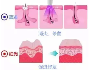 冷红光治疗有什么作用可以治病的神奇光——光疗仪_https://www.jmylbn.com_新闻资讯_第5张