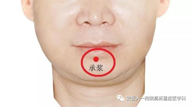 avaps模式怎么读高流量氧疗vs无创通气，如何选择？_https://www.jmylbn.com_新闻资讯_第8张