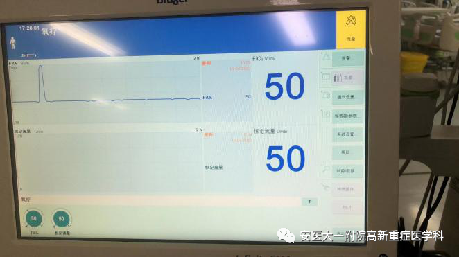 avaps模式怎么读高流量氧疗vs无创通气，如何选择？_https://www.jmylbn.com_新闻资讯_第13张