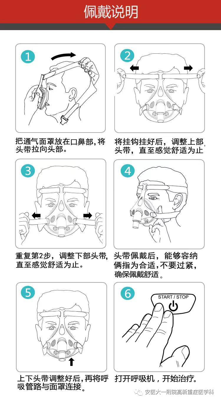 avaps模式怎么读高流量氧疗vs无创通气，如何选择？_https://www.jmylbn.com_新闻资讯_第7张