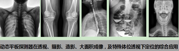 数字胃肠透视怎么做【高端设备】抚顺市中心医院引进OPERA FP系列多功能数字胃肠机_https://www.jmylbn.com_新闻资讯_第6张