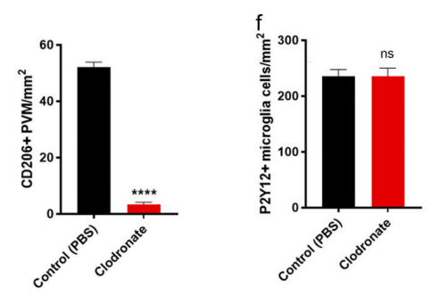 氯膦酸二鈉脂質(zhì)體Clodronate Liposomes·清除腦巨噬細(xì)胞解決方案