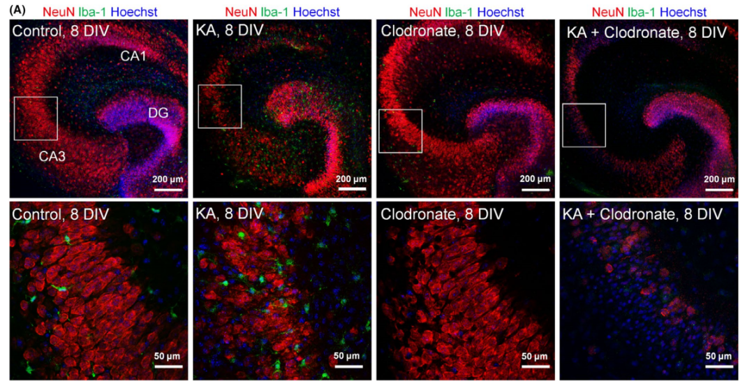 氯膦酸二鈉脂質(zhì)體Clodronate Liposomes·清除腦巨噬細(xì)胞解決方案