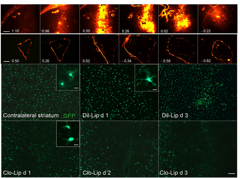 氯膦酸二鈉脂質(zhì)體Clodronate Liposomes·清除腦巨噬細(xì)胞解決方案