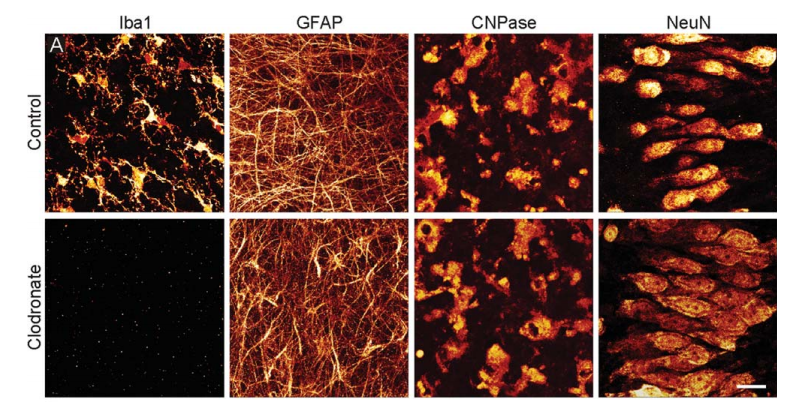 氯膦酸二鈉脂質(zhì)體Clodronate Liposomes·清除腦巨噬細(xì)胞解決方案