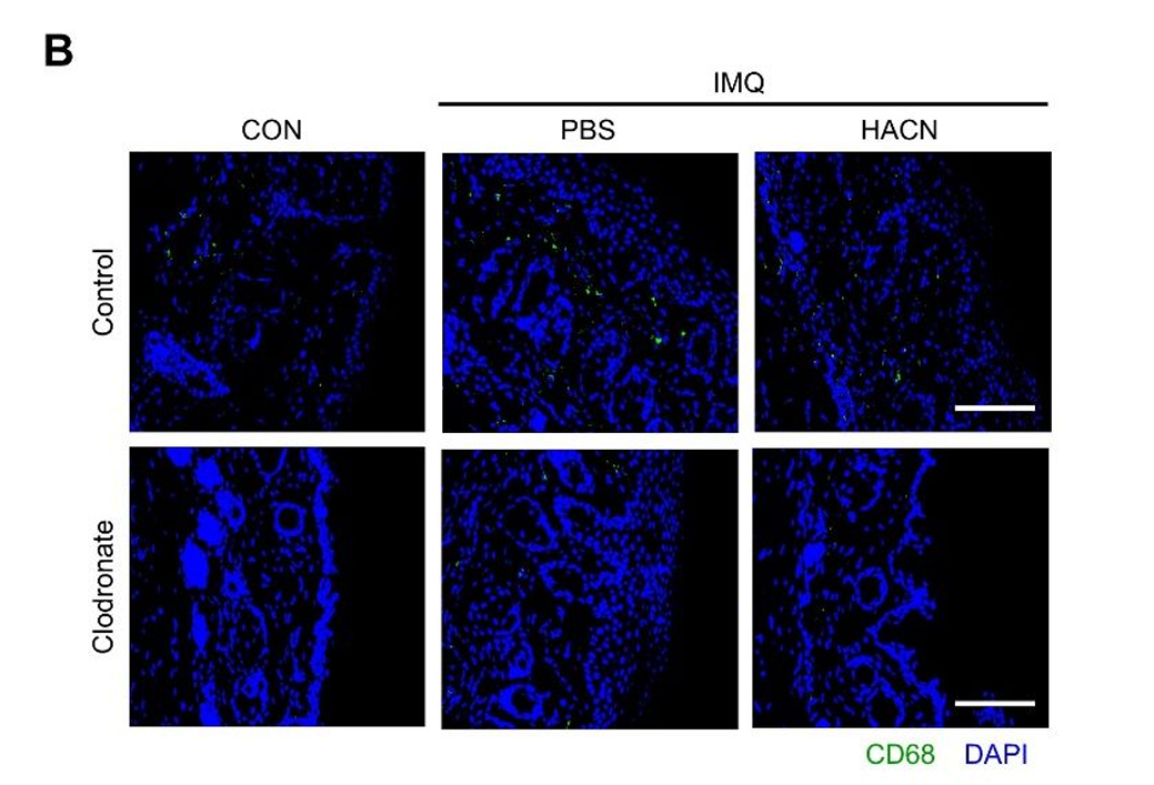 氯膦酸鹽脂質(zhì)體Clodronateliposomes清除皮膚巨細(xì)胞解決方案文獻(xiàn)參考二