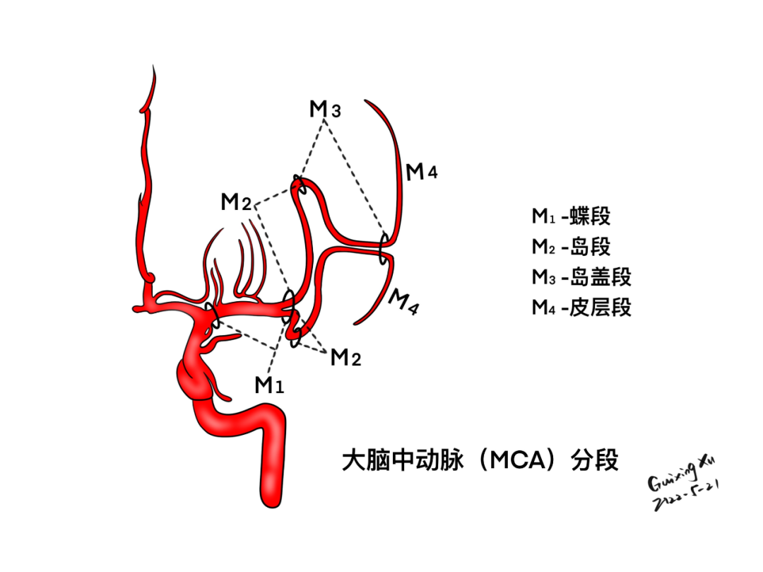 大脑中动脉分段颈内动脉造影(前后位)