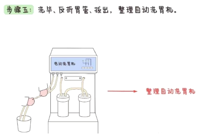 洗胃去什么科【五院·科普】常见急救知识——洗胃术_https://www.jmylbn.com_新闻资讯_第8张