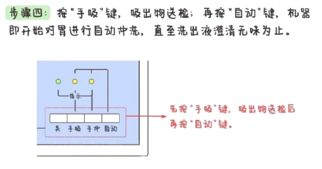 洗胃去什么科【五院·科普】常见急救知识——洗胃术_https://www.jmylbn.com_新闻资讯_第7张