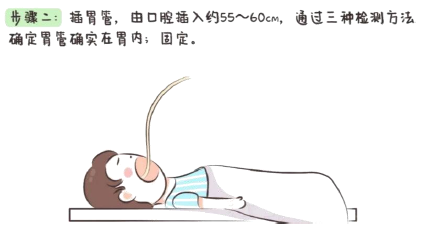 洗胃去什么科【五院·科普】常见急救知识——洗胃术_https://www.jmylbn.com_新闻资讯_第5张