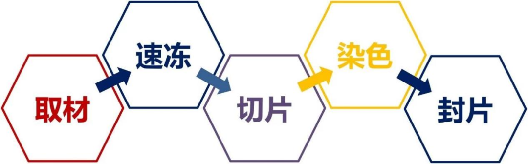 病理取材台怎么清洁【灵一技术】病理科的“急诊”：什么是“术中冰冻病理诊断”？_https://www.jmylbn.com_新闻资讯_第4张
