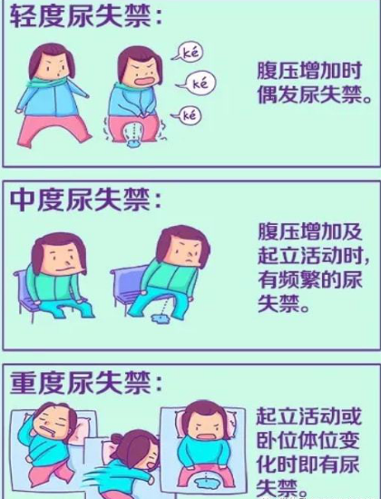 尿道张力过强怎么回事【灵一技术】泌尿外科成功开展多例经阴道闭孔无张力尿道中段悬吊术_https://www.jmylbn.com_新闻资讯_第7张