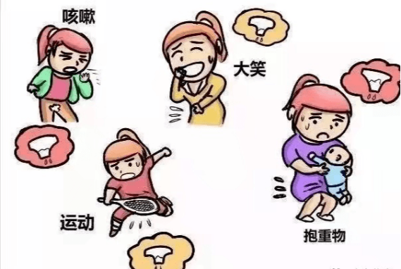 尿道张力过强怎么回事【灵一技术】泌尿外科成功开展多例经阴道闭孔无张力尿道中段悬吊术_https://www.jmylbn.com_新闻资讯_第4张