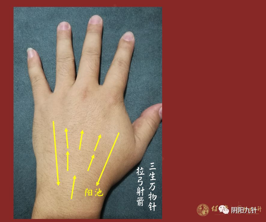 阴阳九针组合针法4腰椎病痛