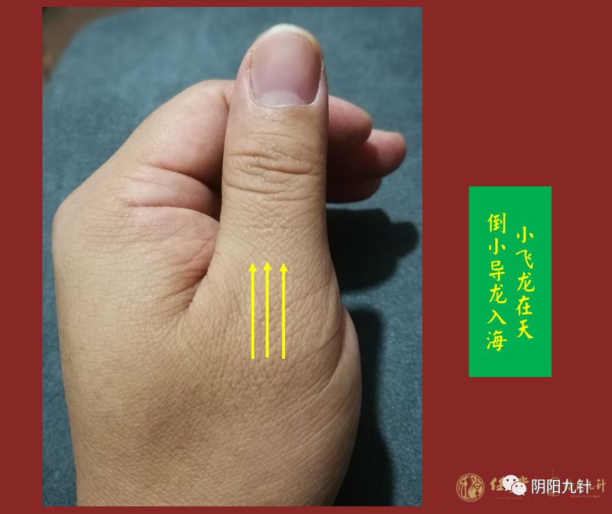 首先,查找腰椎手部全息对应区施针:临床案例摘选自:《阴阳九针2-阴阳