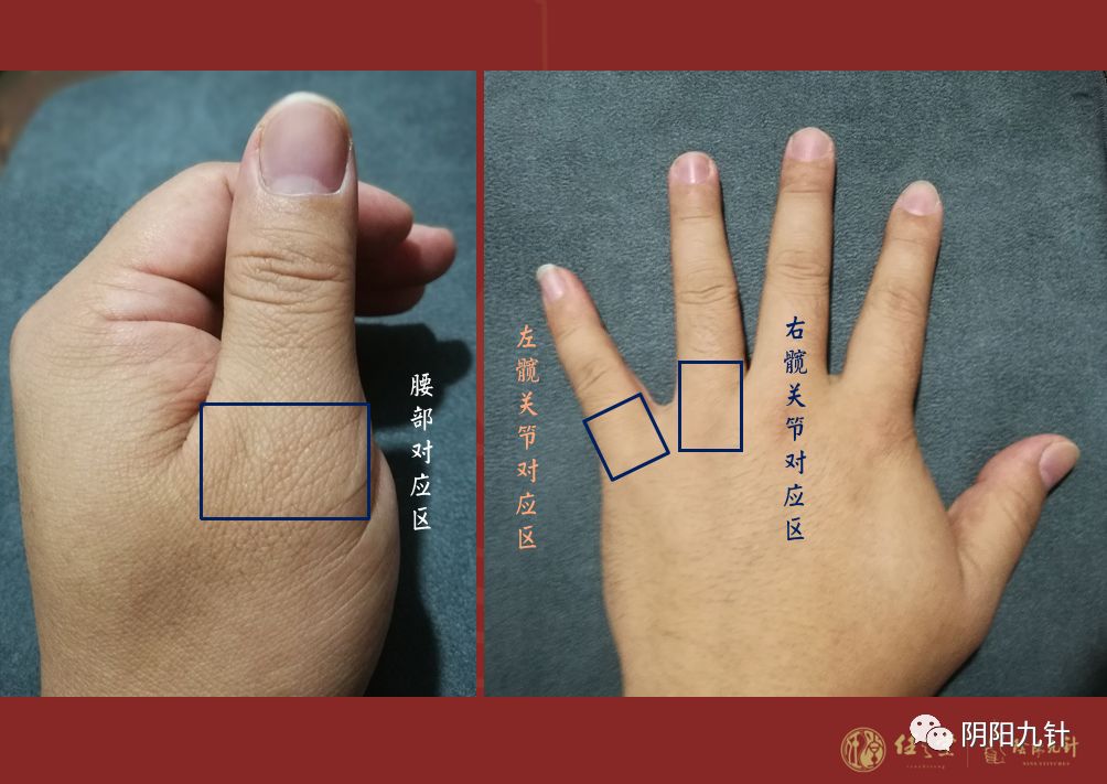 阴阳九针组合针法4腰椎病痛