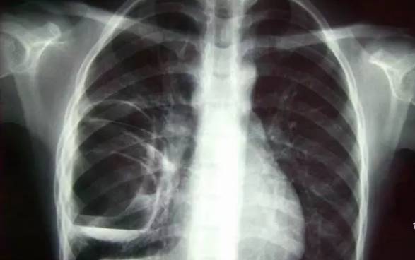 DR影像怎么重新上传【医疗服务提升】MR、CT、DR全新升级，精准影像助力精准诊疗！_https://www.jmylbn.com_新闻资讯_第9张