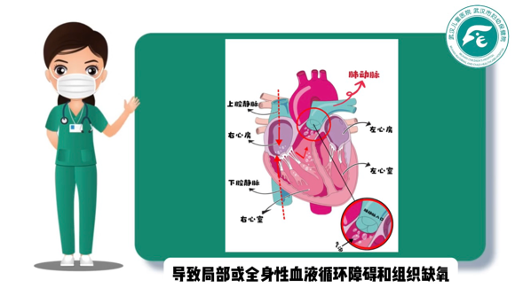 加压输液什么意思正确认识“空气栓塞”——静脉输液中气泡的真相与应对_https://www.jmylbn.com_新闻资讯_第5张