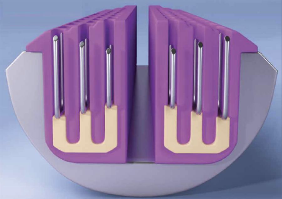 端端吻合器是什么【吻合器简史】谁说只有慢工能出细活？_https://www.jmylbn.com_新闻资讯_第14张