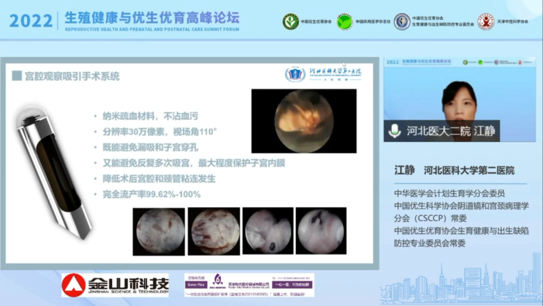 什么是宫腔组织吸引术金山宫腔观察吸引手术系统引领全球女性生育力保护迈入新里程_https://www.jmylbn.com_新闻资讯_第5张