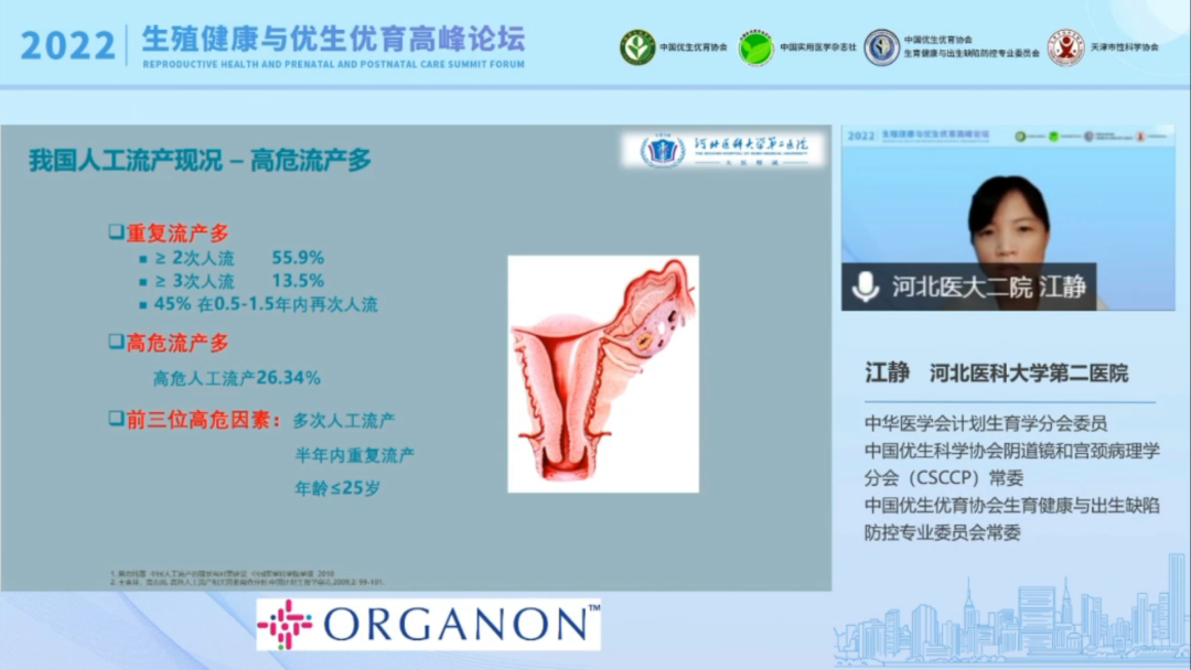 什么是宫腔组织吸引术金山宫腔观察吸引手术系统引领全球女性生育力保护迈入新里程_https://www.jmylbn.com_新闻资讯_第3张