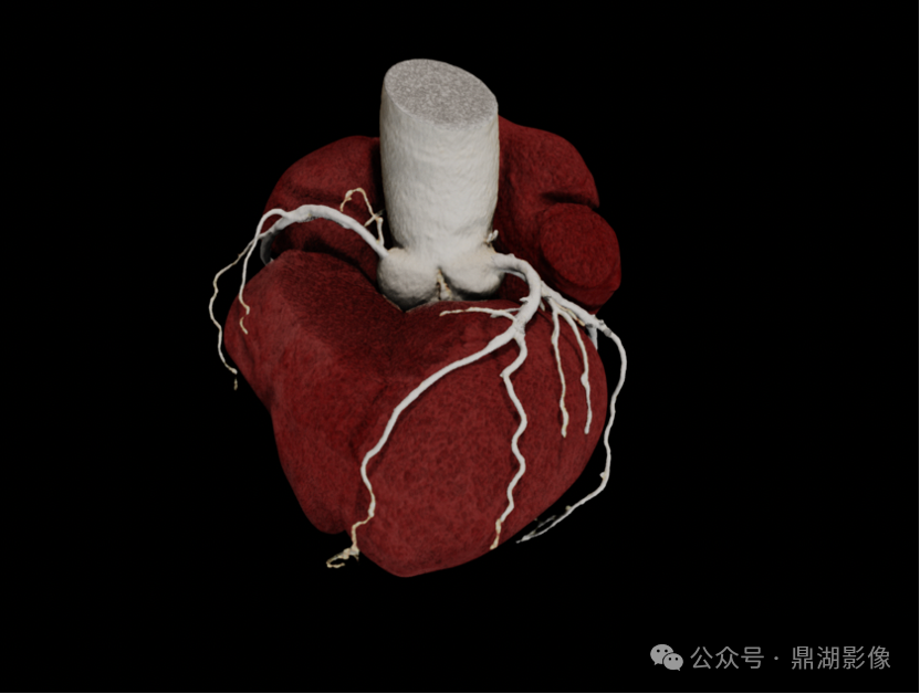 国产的医用ct有哪些国产“双”光子CT横空出世！国产超高端CT的“王炸”来了！_https://www.jmylbn.com_新闻资讯_第7张