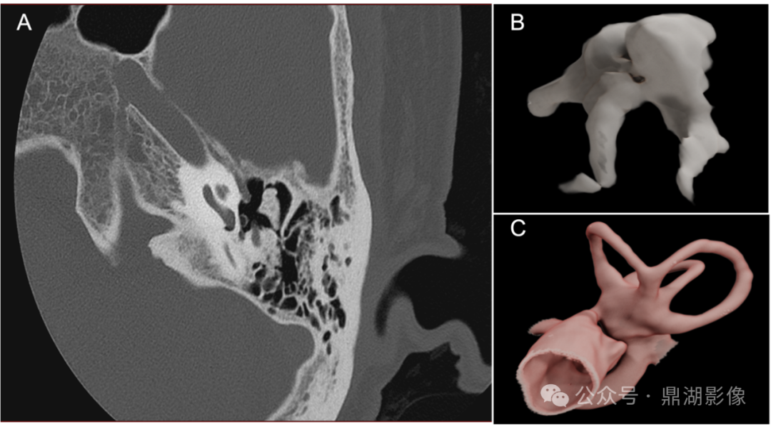 国产的医用ct有哪些国产“双”光子CT横空出世！国产超高端CT的“王炸”来了！_https://www.jmylbn.com_新闻资讯_第11张