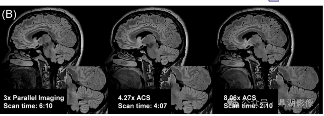 联影磁共振怎么样ISMRM，让世界听到中国磁共振的最强音_https://www.jmylbn.com_新闻资讯_第12张