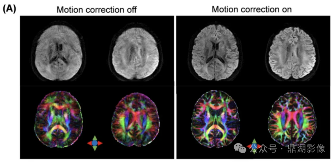 联影磁共振怎么样ISMRM，让世界听到中国磁共振的最强音_https://www.jmylbn.com_新闻资讯_第11张