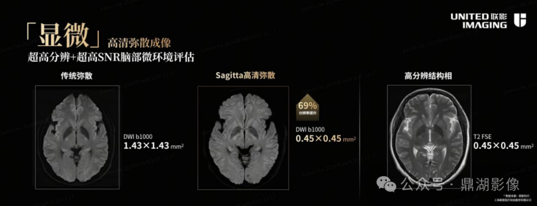 联影磁共振怎么样ISMRM，让世界听到中国磁共振的最强音_https://www.jmylbn.com_新闻资讯_第9张