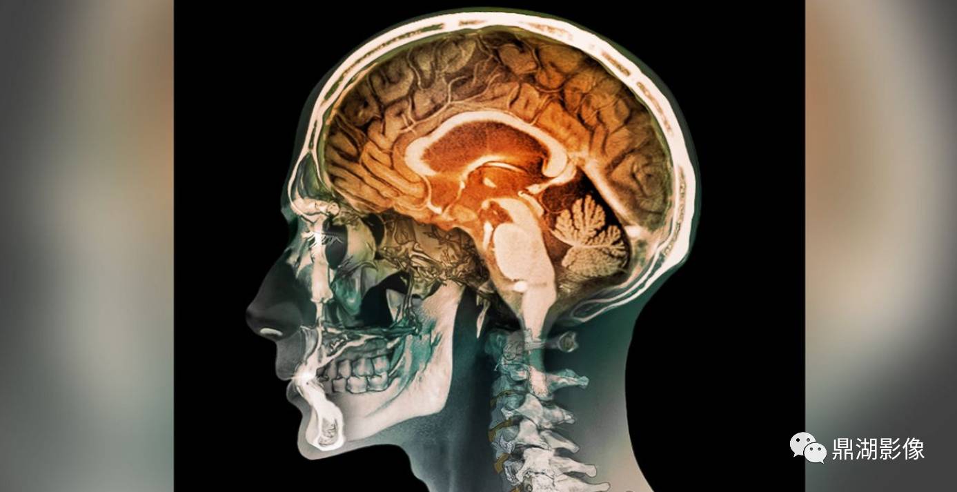 全网最全头颅影像解剖学,不容错过 - 好大夫在线