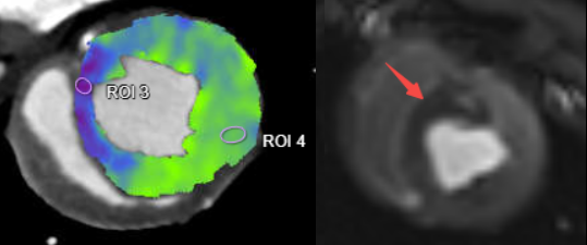 什么是联影ct真香预警？联影医疗双宽体双源CT大揭秘！TA竟然可以看到心脏的高清运动！_https://www.jmylbn.com_新闻资讯_第25张