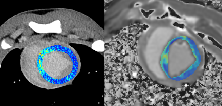 什么是联影ct真香预警？联影医疗双宽体双源CT大揭秘！TA竟然可以看到心脏的高清运动！_https://www.jmylbn.com_新闻资讯_第26张