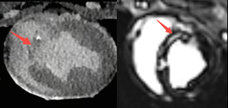 什么是联影ct真香预警？联影医疗双宽体双源CT大揭秘！TA竟然可以看到心脏的高清运动！_https://www.jmylbn.com_新闻资讯_第27张