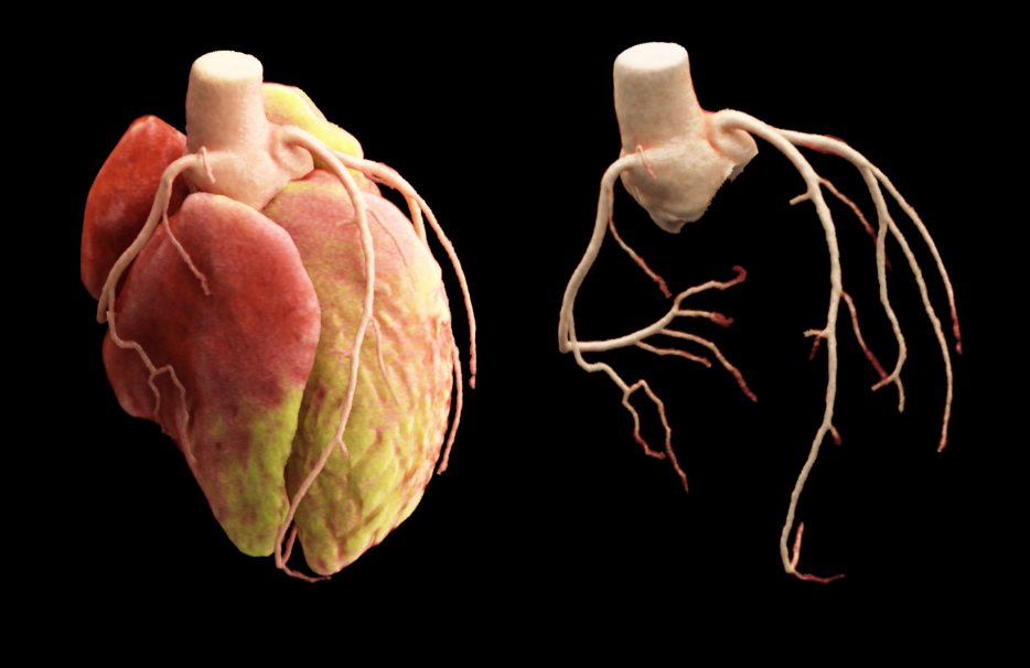 什么是联影ct真香预警？联影医疗双宽体双源CT大揭秘！TA竟然可以看到心脏的高清运动！_https://www.jmylbn.com_新闻资讯_第20张