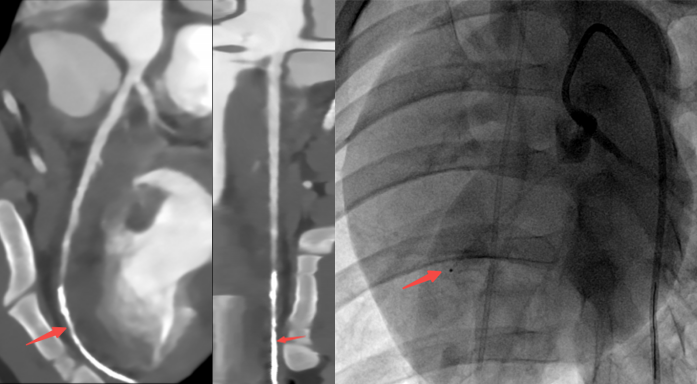 什么是联影ct真香预警？联影医疗双宽体双源CT大揭秘！TA竟然可以看到心脏的高清运动！_https://www.jmylbn.com_新闻资讯_第24张